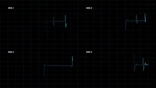 10 EKG Animation 4k after effect project