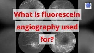 What is fluorescein angiography used for?