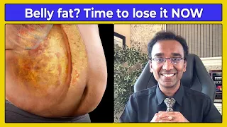 How to lose belly fat NATURALLY without complex dieting | DAWN - DUSK method to BURN fat