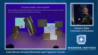 Suzanne Haber, Links Between Reward Motivation and Cognictive Circuits: Stanley and Poitras Centers