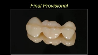 Dental Training Video: Simple and Predictable Temporization for Everyday Practice by Dr. Shah HD