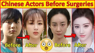 Chinese Actors Before and After Plastic Surgeries 😮 , Incredible Changes, Chinese Drama