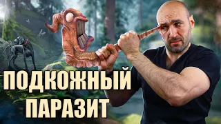 Дирофиляриоз у человека, диагностика, лечение. Реальный опыт врача