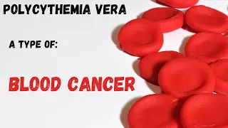 THICK BLOOD, A type of blood cancer (Polycythemia vera) | Symptoms and treatment