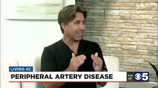 Dr. Correa Talks Peripheral Artery Disease and Venous Insufficiency on Living KC