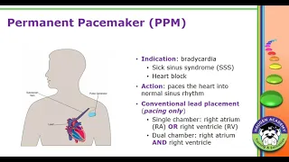 HCGTV: Webinar - Pacemaker and Defibrillator Relationship Status