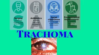 TRACHOMA  #medical_video #ophthalmology #mbbs #trachoma