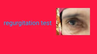 regurgitation test/ophthalmology methods/nld block/watering eyes/purulent eye discharge