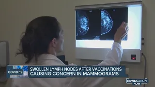 Swollen lymph nodes after COVID-19 vaccinations causing concern in mammograms