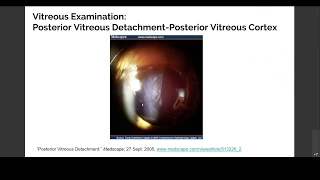 Part 2:  Examination of Vitreous and Floaters