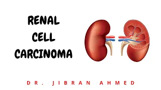 RENAL CELL CARCINOMA II ROBBINS 10TH E II KIDNEY II PATHOLOGY LECTURES