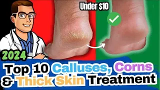 How to REMOVE Thick Dry Skin, Calluses & Corns [HOME Remedies]