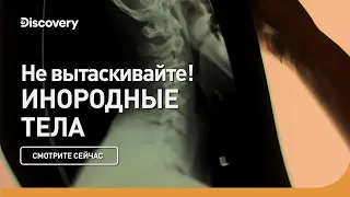 Не вытаскивайте! | Инородные тела | Discovery