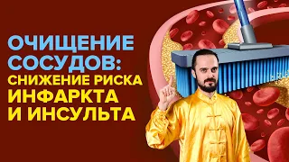 ЭТИ 5 Упражнений Чистят Сосуды, Снижают Риск Инфаркта и Инсульта! Очищение в домашних условиях