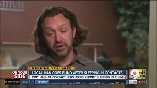 Cincinnati man goes blind in one eye after sleeping in contacts