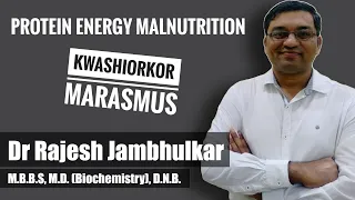 PROTEIN ENERGY MALNUTRITION (PEM)- Kwashiorkor and Marasmus