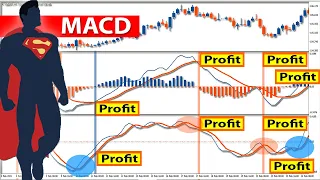 🔴 SUPER MACD "High Win Rate SCALPING Strategy" | Best MACD-RVI Indicator for SCALPING & Day Trading