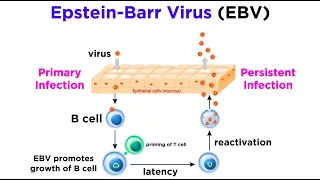Mononucleosis (Epstein-Barr Virus)