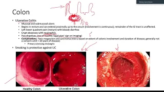 GI Path for USMLE Step 1 - Lecture 1