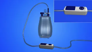 Caring for your Rocket® IPC™ Pleural Drainage Catheter 1