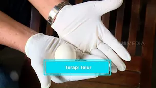 Mencoba Terapi Telur | SEHAT SANTUY (25/04/21)