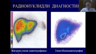 Гепатодуоденал ва сийдик ажратиш тизими касалликларини  нурли  диагностикаси