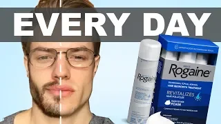 I Put Rogaine On My Face Everyday For A Year, Here's What Happened