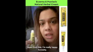 Free Eczema and Psoriasis Herbal Natural Treatment Cream that Works Like Magic to Cure Skin Disease