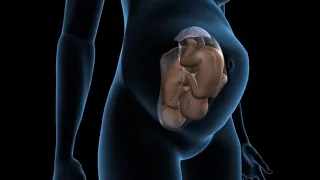 Types of twins pregnancy - Dichorionic twins - 3D Anatomical Visualization