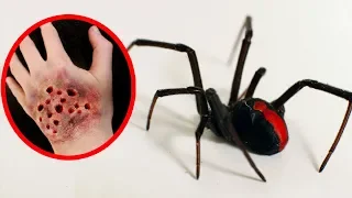 THE MOST POISONOUS SPIDERS In The World