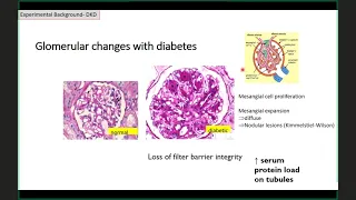 UofL Endocrinology Grand Rounds: Dr. Michael Merchant