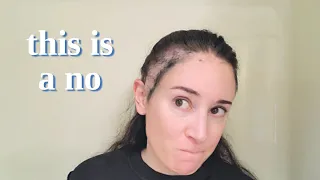 Trying 3 Bald Spot Covering Methods | Frontal Fibrosing Alopecia