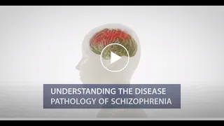 Understanding the pathology of Schizophrenia