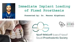 Immediate Implant Loading of Fixed Prosthesis