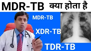 MDR-TB // XDR-TB //TDR-TB // MDR TB kya hota hai // #DrSanjaychestSpecialist