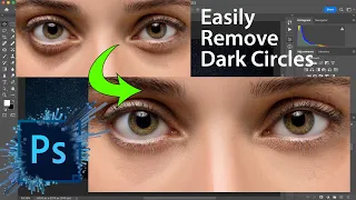 Effective| Very Easily Remove Deep Dark Circles Flawlessly in Photoshop! Pix Imperfect Trending