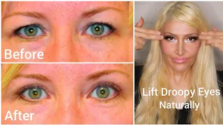 How To Lift Drooping Eye Lids Naturally | Exercises For Younger Looking Eyes | Reverse Aging Eyes