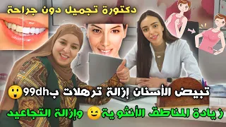 دكتورة تجميل دون جراحة🥰تبيض الأسنان إزالة ترهلات ب99dh😲زيادة المناطق الأنثوية و إزالة تجاعيد😉