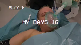 MY DAYS 16: TUMMY TUCK & BRAZILIAN BUTT LIFT | Henry Harjusola