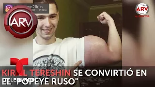 Este joven se convirtió en el Popeye ruso a punta de inyecciones | Al Rojo Vivo | Telemundo