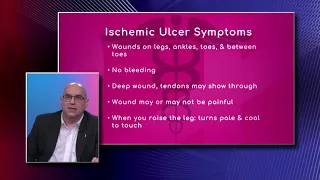 Ischemic Ulcers - First Choice Neurology - Dr. Antonio Mesa