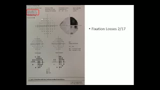 Automated Visual Field - Part 3 - Reliability Indicators