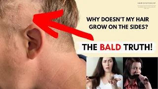 Why is My Hair Always So Short on the Sides? Here's the Truth