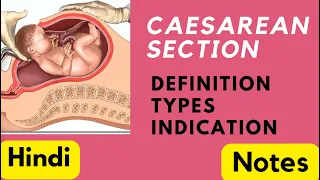 Caesarean Section : Definition, Types, Indications | NOTES | Easy Explaination in Hindi