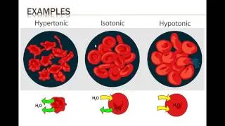 Hypertonic-Hypotonic