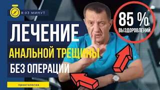 Без операции 85% успеха! Лечение УПОРНЫХ анальных трещин!