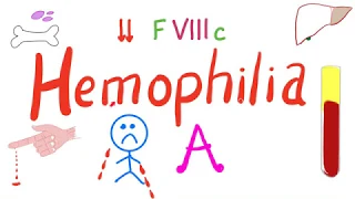 Hemophilia A | Most Comprehensive Explanation | Hematology