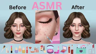 ASMR Young girl Remove Puberty Acne on Face  Pimple Popping Facial Treatment ASMR Face Treatment