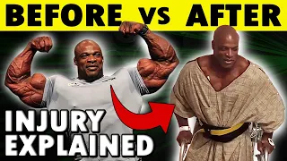 RONNIE COLEMAN: HE PAID A HIGH PRICE | Bodybuilding News 2023