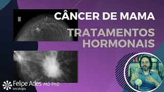 CÂNCER DE MAMA | Tratamentos hormonais